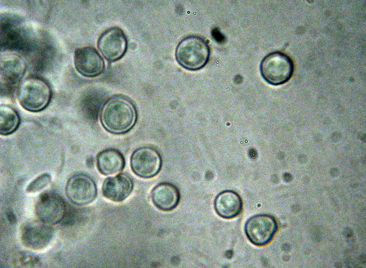 In parcheggio (Granulobasidium vellereum)